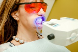 Лазерное отбеливание зубов в стоматологии