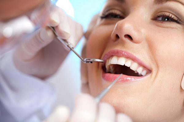 Как избавиться от зубного налета