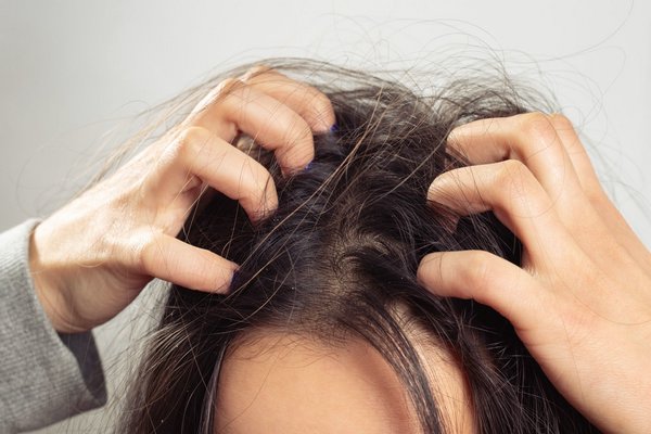 Как справиться с зудом кожи головы